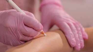 Lazer tüy temizleme uzmanı kadınların eline koruyucu kalemle benler çizer. Eldivenli kadın elleri, bölgeyi bir kalemle epilasyon ve benlerin korunması için işaretliyor..