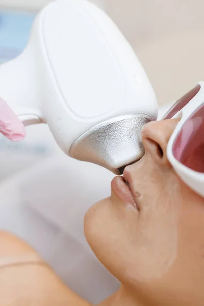 Laserontharing Snorharen Verwijderen Vrouw Een Laserontharingssalon Meisje Snor Laser Ontharing — Stockfoto