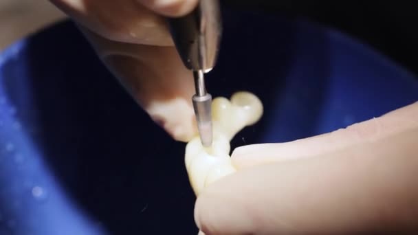 Крупним Планом Чоловічий Стоматолог Дрилем Стоматологічній Лабораторії Стоматологічний Протез Штучний — стокове відео