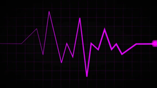 Normale Hartslaglijn Elektrocardiogram Sinusritme Ecg Ecg Een Indicatie Van Leven — Stockfoto