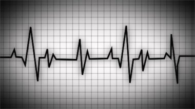Kalp atış hızı grafiği. Kalp atışı. Ekg dalga simgesi. Kalp atışı grafiği. Elektrokardiyogramda kalp atışı normal. EKG. EKG. Yaşam belirtisi var. Sağlık için tıbbi sembol