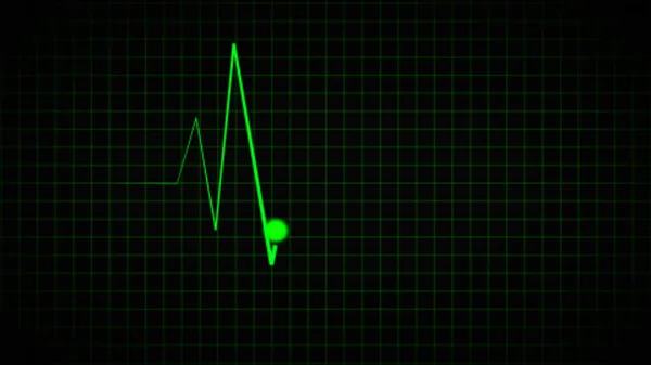 Векторна Ілюстрація Лінії Монітора Серцевого Ритму Напівпрозорому Тлі Ілюстрація Пульсового — стокове фото