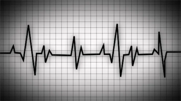 Графік Серцевого Ритму Серцебиття Значок Хвилі Екга Графік Серцебиття Нормальна — стокове фото