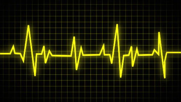 心電図上の通常のハートビートライン 洞のリズム EcgとEkg 生命の兆候だ 健康の象徴として — ストック写真