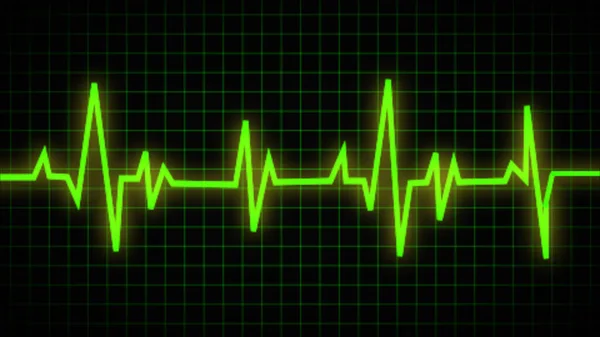 Електрокардіограма Або Екг Кінець Життєво Життєвої Лінії Медичний Дизайн Серцебиття — стокове фото