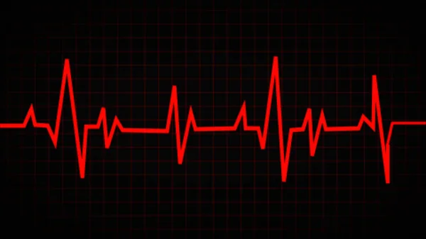 Szívverés Neon Vonal Hullám Egy Elektrokardiogram Ekg Monitor Ekg Pulzusszám — Stock Fotó