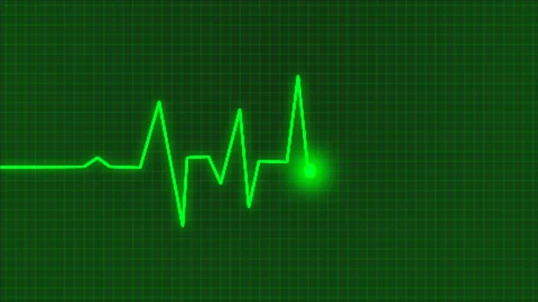 Monitoraggio Ecg Caso Emergenza Neon Blu Accende Battito Cardiaco Battito — Foto Stock