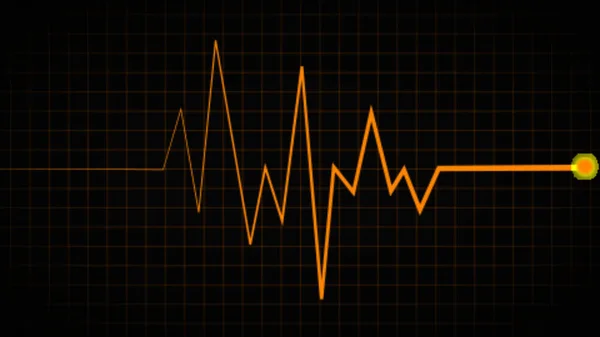 心电图心跳显示 心电图 屏幕绿色图表背景上的脉冲频率线 心率和心电图监测图 — 图库照片