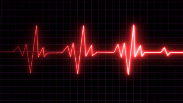 Hartslag Elektrocardiogram Ecg Monitoring Geval Van Nood Elektrocardiogram Ecg Einde — Stockfoto