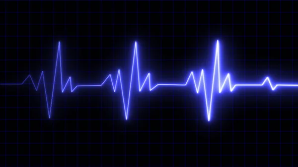Monitorização Ecg Caso Emergência Batimento Cardíaco Sob Luz Azul Brilhante — Fotografia de Stock