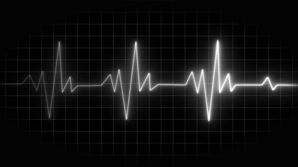 心电图心律失常监测器 心动图心动过速 心脏停止和死亡的三色心电图 心电图脉线波 — 图库照片