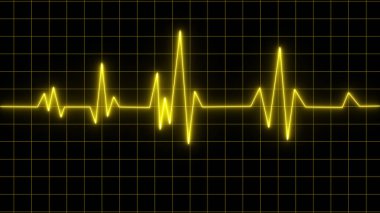 Kırmızı grafik kağıdında sarı kalp atışı diyagramı. Elektrokardiyogram şeması. Kalp krizi geçirdi. İskemik. Koroner arter hastalığı. Anjina pektoris. Göğüs ağrısı. EKG. EKG. Sağlık hizmetleri.