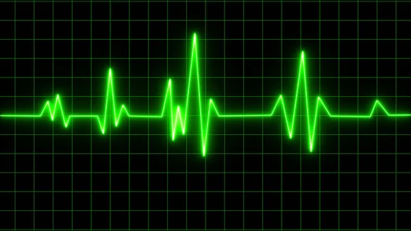 Візерунок Показу Електрокардіограми Stemi Серцевий Напад Ішемічна Хвороба Коронарних Артерій — стокове фото