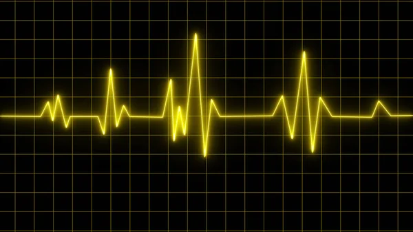 Gelbes Herzschlagdiagramm Auf Rotem Graphenpapier Elektrokardiogramm Herzinfarkt Ischämisch Koronare Herzkrankheit — Stockfoto