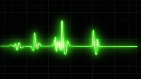 Ekg Monitor Grafikája Orvosi Témához Ragyogó Digitális Szívverés Vonal Tükröződik — Stock Fotó