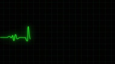 EKG Elektrokardiyogram Ekran Döngüsü. Kalp atış hızı monitörü elektrokardiyogram tıbbi monitörü.