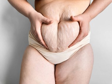 Doğum sonrası göbeğini kapat ve ellerinle tut. Gerçek kadın vücudu, annelik değişimleri ve kendini kabullenme kavramı. Yüksek kalite fotoğraf