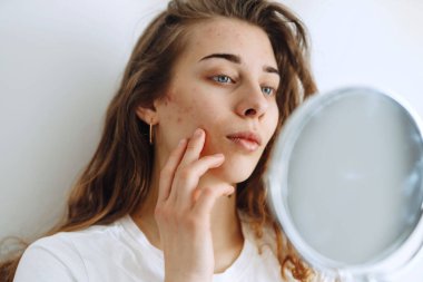 Derisi sorunlu genç bir kadın aynaya bakıyor. Dermatoloji. Kozmetik, kırmızı nokta ya da yüzündeki kızarıklıktan kaynaklanan alerjik reaksiyon. Güzellik bakımı. 
