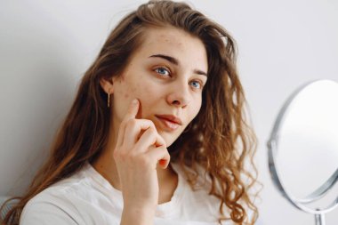 Derisi sorunlu güzel bir kadın aynaya bakıyor. Dermatoloji. Kozmetik, kırmızı nokta ya da yüzündeki kızarıklıktan kaynaklanan alerjik reaksiyon. Cilt sorunundan güzellik bakımı.
