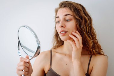 Deri sorunu. Kıvırcık kadın parlak bir odada aynaya bakarken yüzündeki kırmızı iltihaplara dokunuyor. Yüz derisi sorunları. Güzellik bakımı. Alerjik reaksiyon.