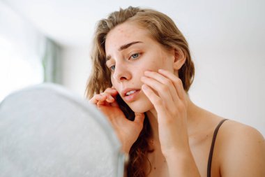 Deri sorunu. Kıvırcık kadın parlak bir odada aynaya bakarken yüzündeki kırmızı iltihaplara dokunuyor. Yüz derisi sorunları. Güzellik bakımı. Alerjik reaksiyon.