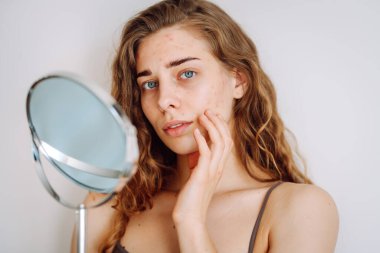 Deri sorunu. Kıvırcık kadın parlak bir odada aynaya bakarken yüzündeki kırmızı iltihaplara dokunuyor. Yüz derisi sorunları. Güzellik bakımı. Alerjik reaksiyon.