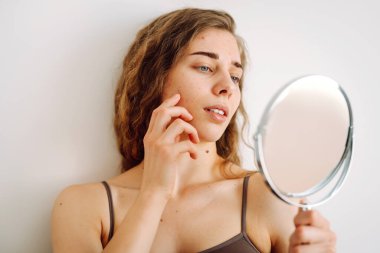 Deri sorunu. Kıvırcık kadın parlak bir odada aynaya bakarken yüzündeki kırmızı iltihaplara dokunuyor. Yüz derisi sorunları. Güzellik bakımı. Alerjik reaksiyon.