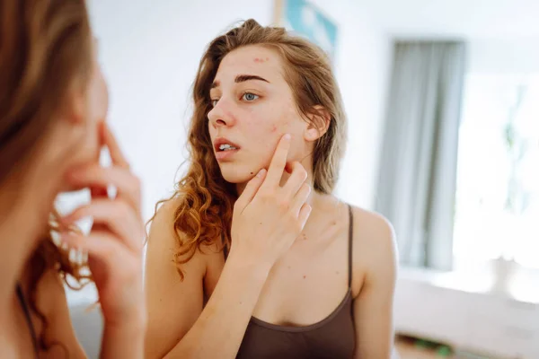 Potret Seorang Wanita Muda Menyentuh Jerawat Wajahnya Saat Melihat Cermin Stok Foto Bebas Royalti