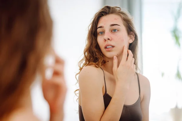 Potret Seorang Wanita Muda Menyentuh Jerawat Wajahnya Saat Melihat Cermin Stok Lukisan  