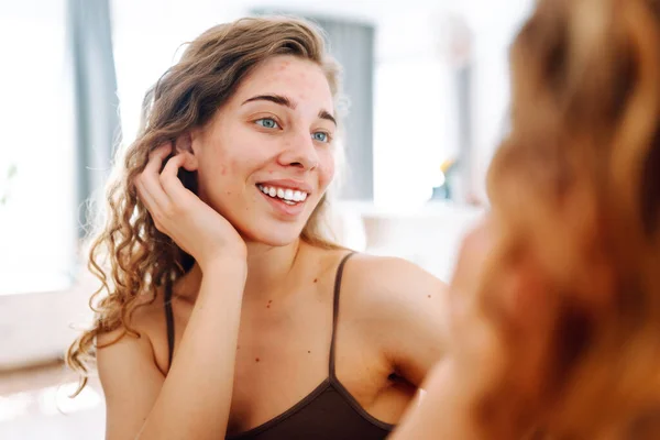 Potret Seorang Wanita Muda Menyentuh Jerawat Wajahnya Saat Melihat Cermin Stok Foto Bebas Royalti