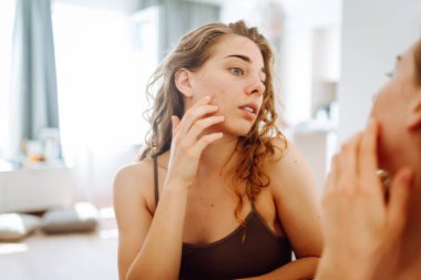 A young woman looks in the mirror examining inflammation on her face. Acne skin. Copy space. Medicine and cosmetology. clipart