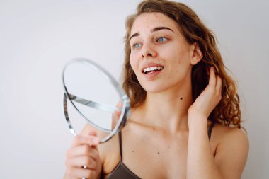 Close-up of a cute woman with problem skin looking in the mirror. A curly woman with rashes on her face is worried about the health of her skin. Dermatology concept, allergy.