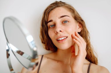 Close-up of a cute woman with problem skin looking in the mirror. A curly woman with rashes on her face is worried about the health of her skin. Dermatology concept, allergy.