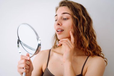 Kusurlu ciltli makyajsız güzel bir kadının portresi. Sivilce derisi. Doğal güzellik. Tıbbi bakım ve tedavi kavramı.