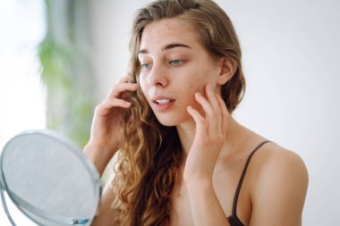 Kusurlu ciltli makyajsız güzel bir kadının portresi. Sivilce derisi. Doğal güzellik. Tıbbi bakım ve tedavi kavramı.