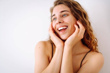 Derisi sorunlu genç bir kadın. Sivilceli bir hayat. Derisi kızarıklığa, sivilceye ve yaralara yatkın. Dermatoloji ve kozmetoloji kavramı.