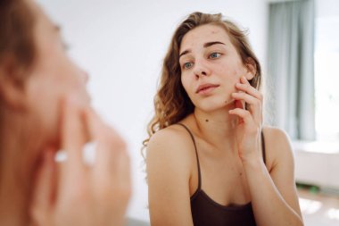 Sorunlu ciltli güzel bir genç kadın. Sivilce sorunu kavramı