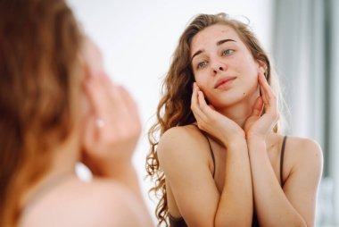 Sorunlu ciltli güzel bir genç kadın. Sivilce sorunu kavramı