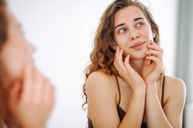 Sorunlu ciltli güzel bir genç kadın. Sivilce sorunu kavramı