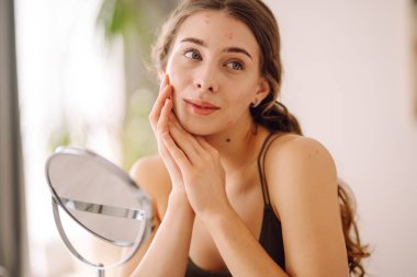 Sivilceli makyajsız genç bir kadının portresi. Sivilce terapisi, yara, yüz iltihabı ve sorunlu cilt kavramı..