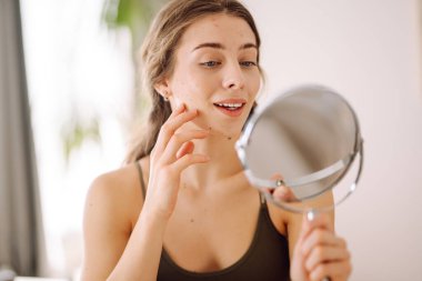 Sivilceli makyajsız genç bir kadının portresi. Sivilce terapisi, yara, yüz iltihabı ve sorunlu cilt kavramı..