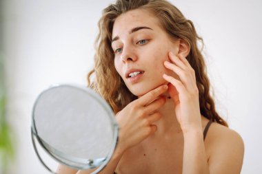 Güzel bir kadın aynaya bakıyor, elleriyle yüzüne dokunuyor, sivilceleri ve pigmentasyonu inceliyor. Rosacea ve couperose konsepti. Kozmetik bakım. Alerjik reaksiyon.