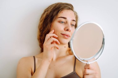 Güzel bir kadın aynaya bakıyor, elleriyle yüzüne dokunuyor, sivilceleri ve pigmentasyonu inceliyor. Rosacea ve couperose konsepti. Kozmetik bakım. Alerjik reaksiyon.