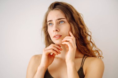 Yüzünde kırmızı lekeler olan bir kadın. Sağlık sorunları, deri hastalıkları. Tıp ve kozmetoloji kavramı.