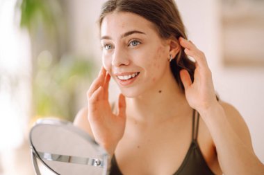 Derisi sorunlu genç bir kadın aynaya bakıyor. Sivilce terapisi kavramı, yara izleri, yüzünde iltihap, sorunlu cilt. Güzellik bakımı.