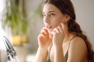 Derisi sorunlu genç bir kadın aynaya bakıyor. Sivilce terapisi kavramı, yara izleri, yüzünde iltihap, sorunlu cilt. Güzellik bakımı.