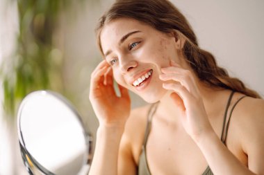 Derisi sorunlu genç bir kadın aynaya bakıyor. Sivilce terapisi kavramı, yara izleri, yüzünde iltihap, sorunlu cilt. Güzellik bakımı.