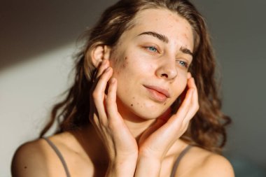 Yüzünde sorun olan bir kadın. Tıp ve kozmetoloji kavramı. Doğal cilt.