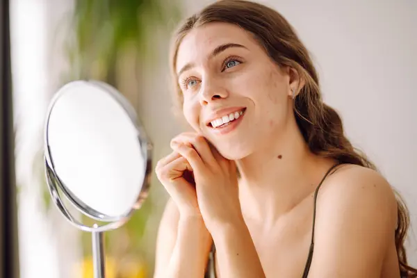 stock image Portrait of a young woman without makeup with Acne skin. Skin problems, first mimic wrinkles or acne pimples, annoyed by blackheads.