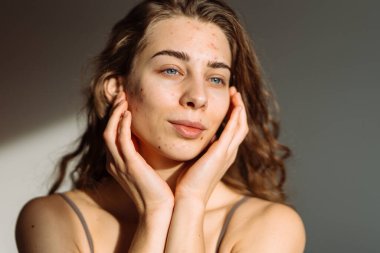Genç bir kadın, doğal güzelliğini ve cilt kusurlarını sergileyerek yan tarafa bakarken yüzüne dokunuyor. Tıp ve kozmetoloji kavramı. Doğal cilt.